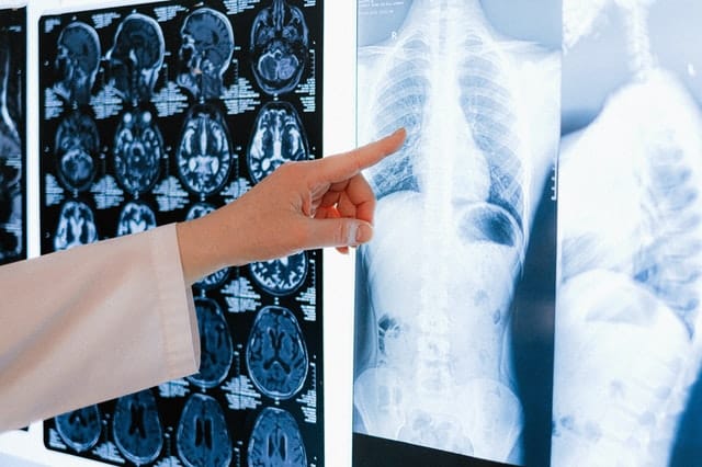 Artificial Intelligence (AI) for Disease Diagnosis